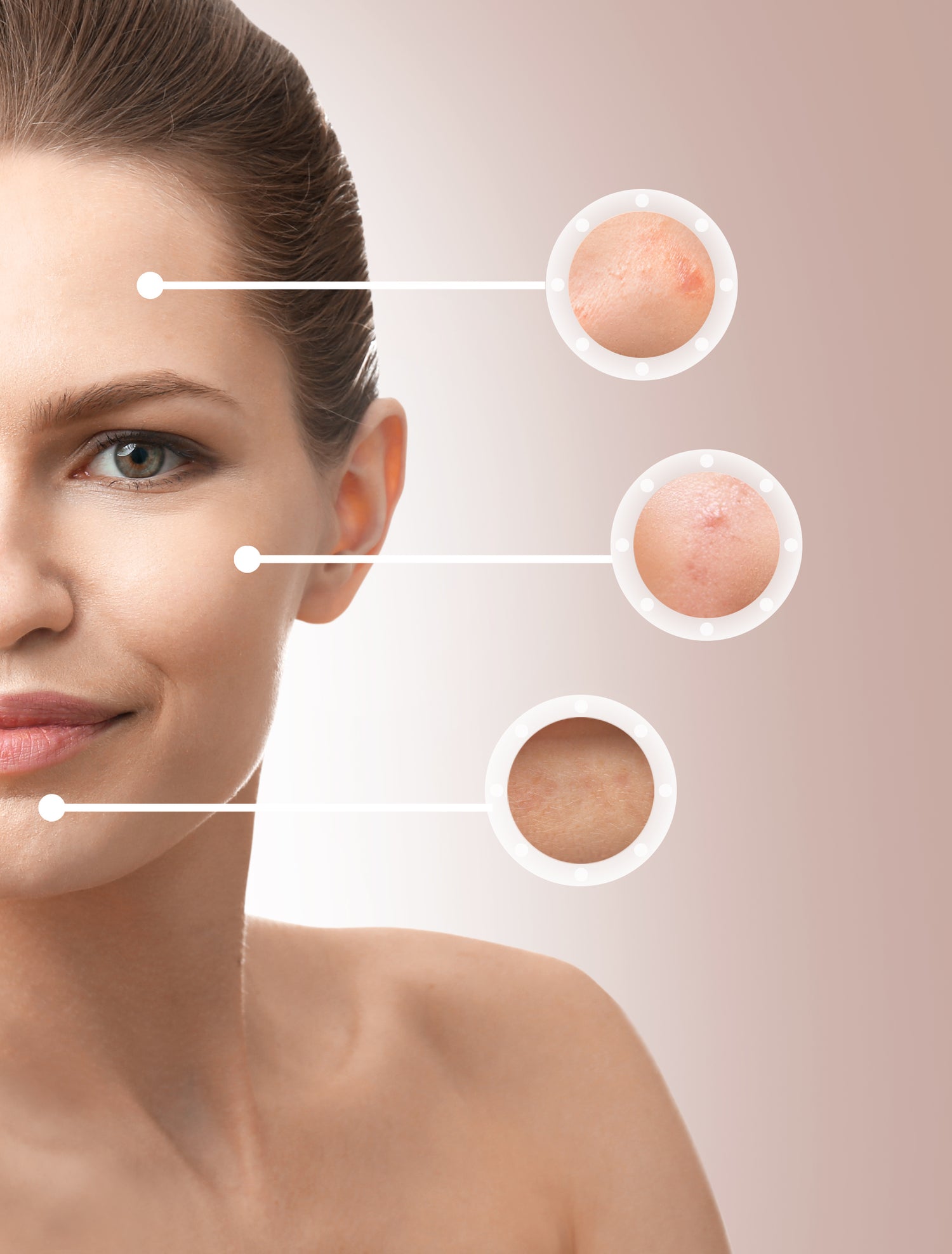 Acne-prone skin with visible blemishes and inflammation.