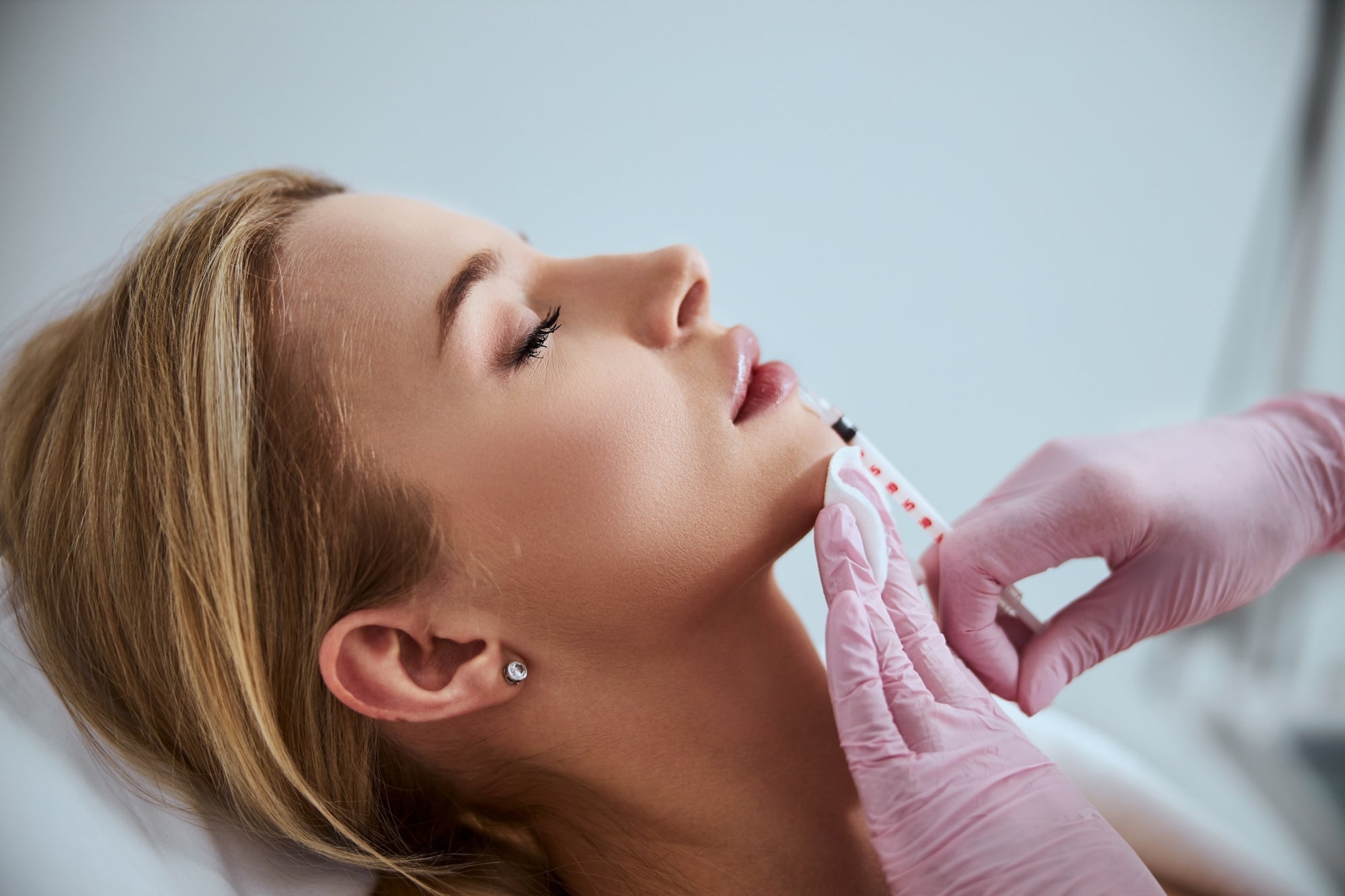 Filler injection for facial volume restoration and wrinkle reduction.