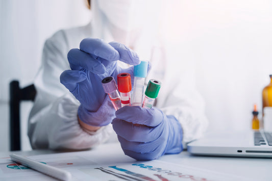 Lab test procedure for medical diagnostics and health analysis.