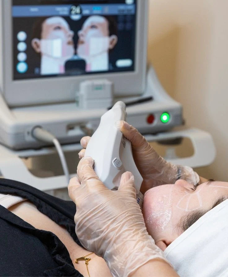 Ultherapy treatment for non-invasive skin lifting and tightening.